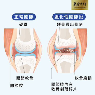(2025更新)關節保健全攻略！UC-II是什麼、功效與推薦品牌大評比